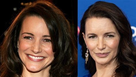 did kristin davis have plastic surgery